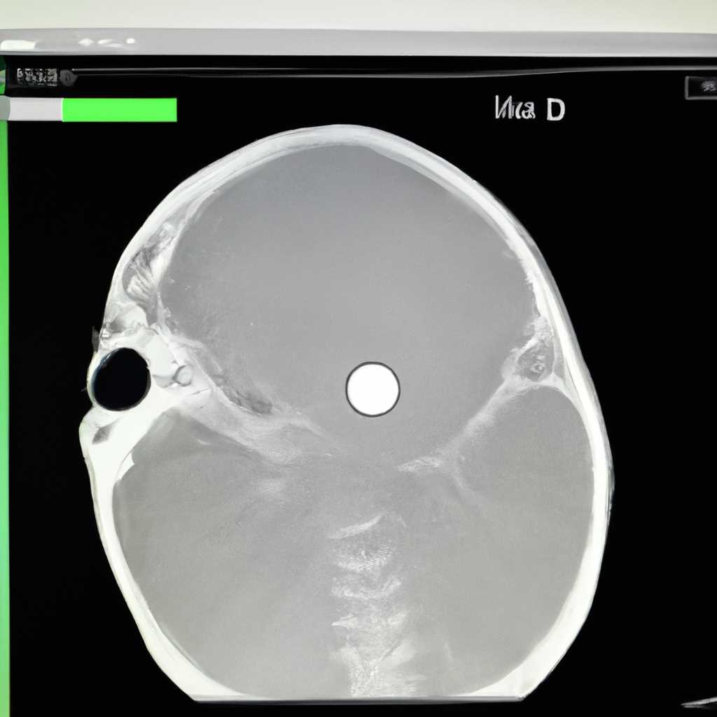 Radiant DICOM Viewer для Mac OS - простой и удобный просмотрщик медицинских изображений